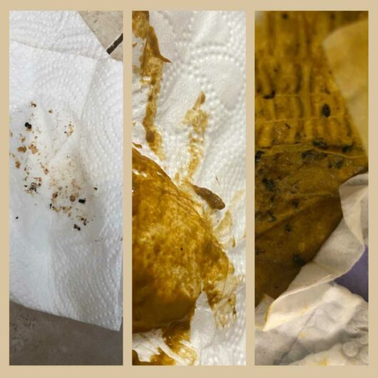 Coffee Ground Poop, Causes, Identification & Treatment 2024