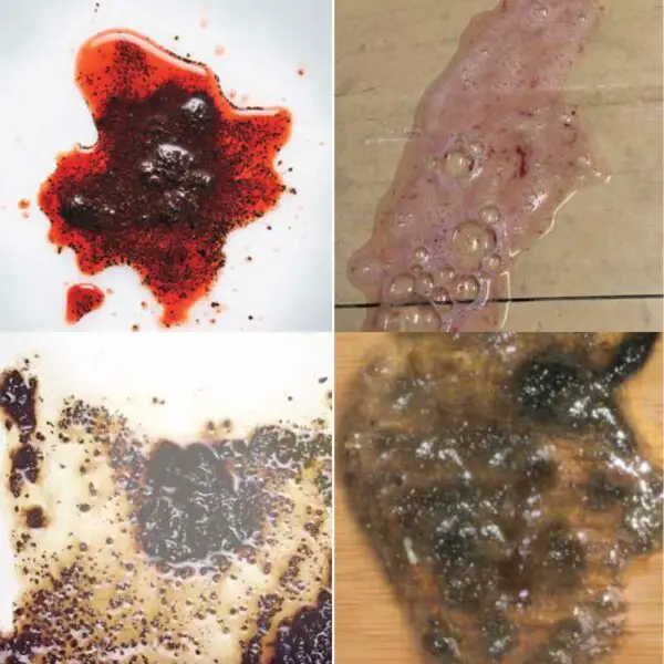 Coffee Ground Poop, Causes, Identification & Treatment 2025